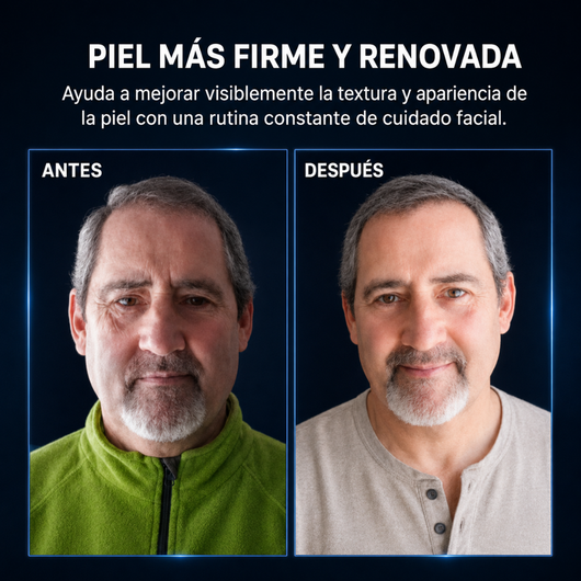 Crema con Retinol | Más joven en 17 días